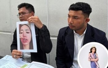 Modal “Orang Dalam”, Finalis Puteri Indonesia Riau Buka Klinik Kecantikan dan Bikin Pasien Cacat Permanen