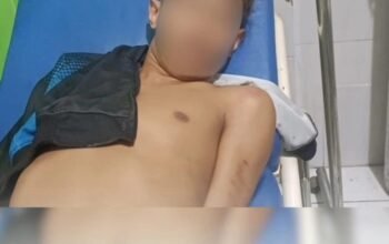 Kabur Usai Diduga Habisi Nyawa Suwardi Gani, DA Ditembak Polisi di Pelabuhan Bastiong